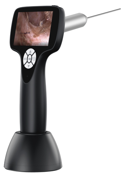 Black Verpie portable ENT endoscope